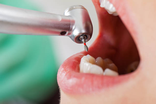 Best Weekend Emergency Dentist in Sebastian, TX